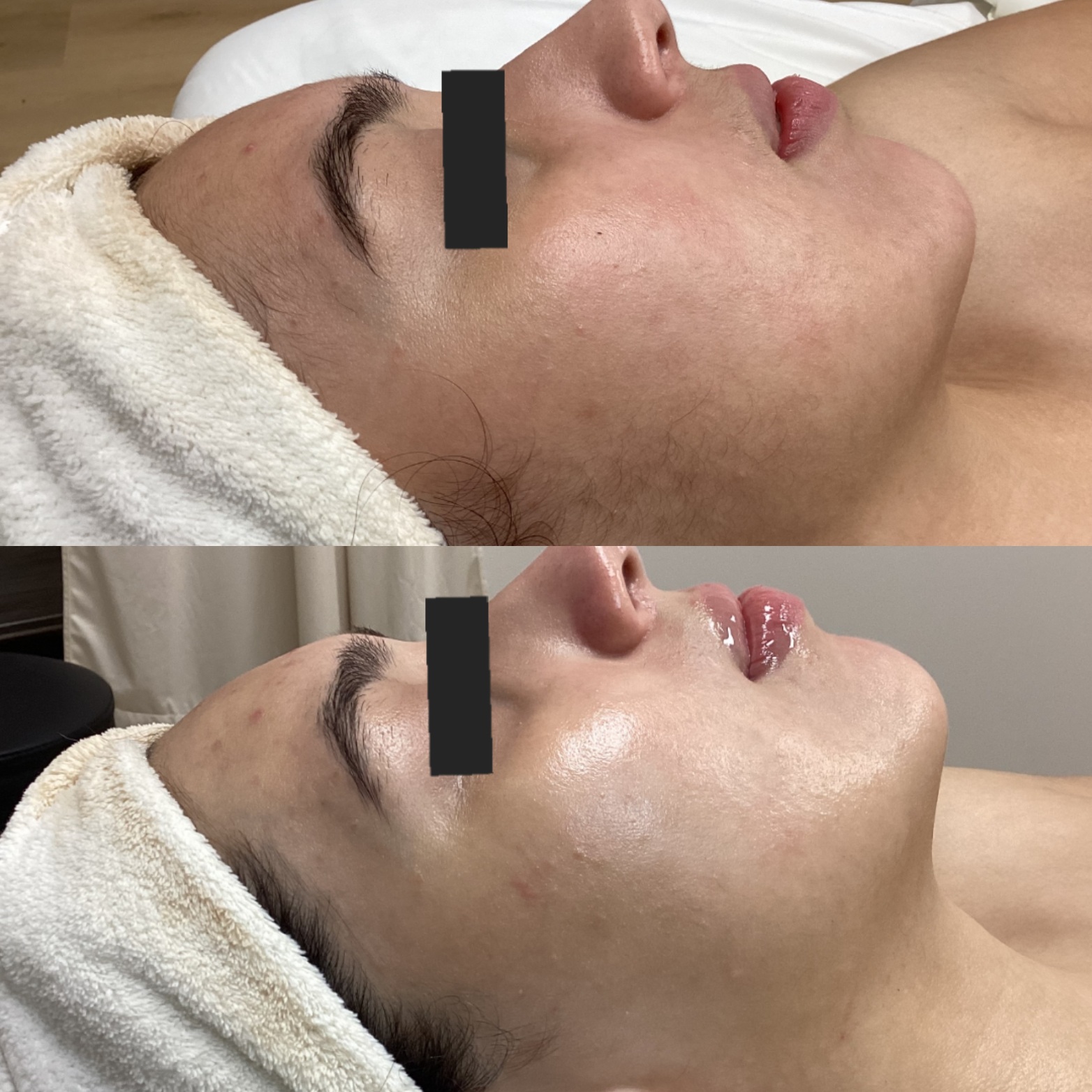 Before and after result 1