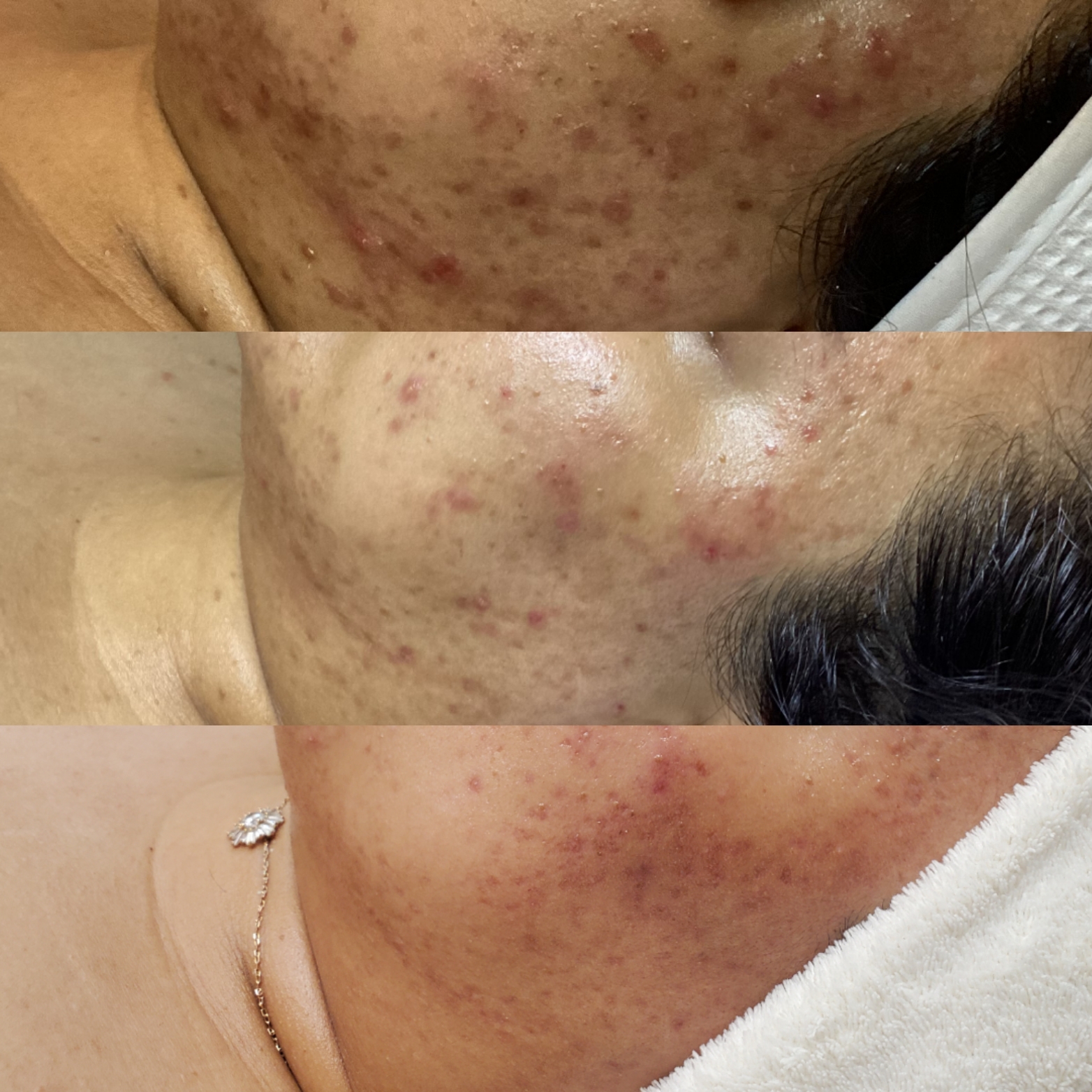 Before and after result 3