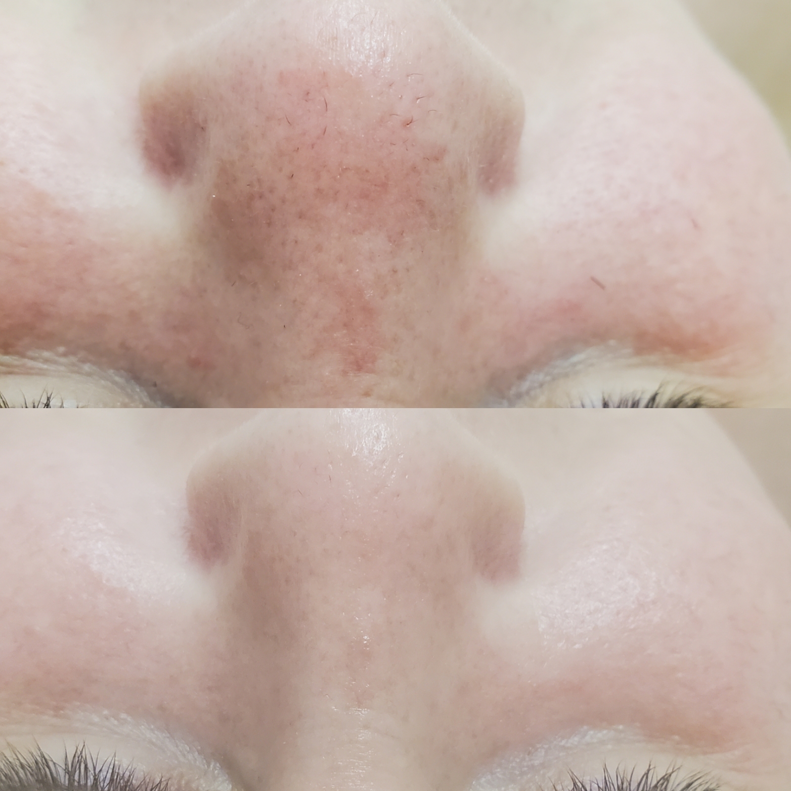 Before and after result 6