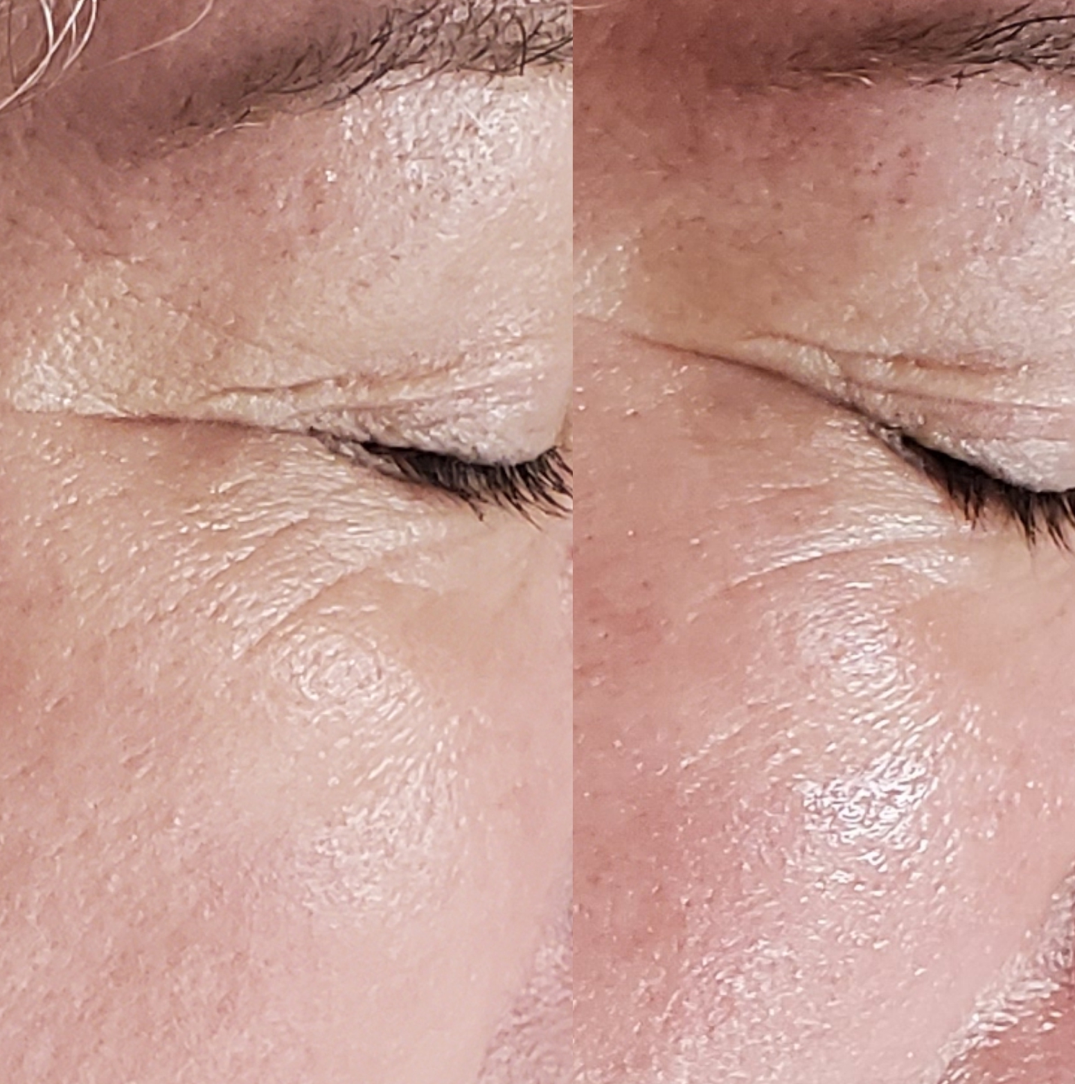 Before and after result 8